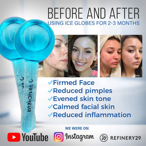FRAÎCHEUR ICE Globes | Cryo Facial Roller Cold Skin Massagers | Glass Bulbs with Anti-Freeze Solution | Eyecicle Rollers Reduce Puffiness | Bonus Massage Techniques eBook (Blue)